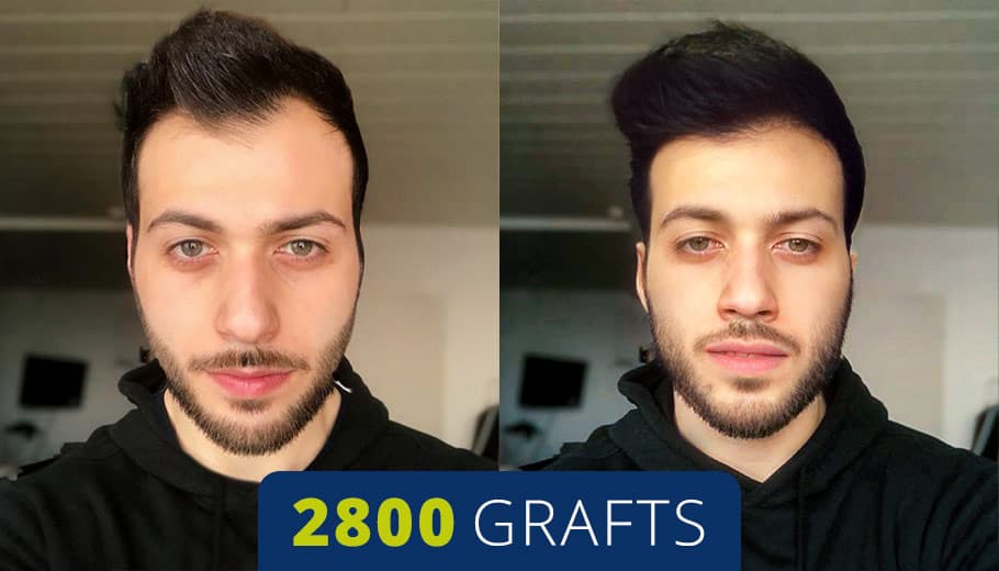 Before and after example