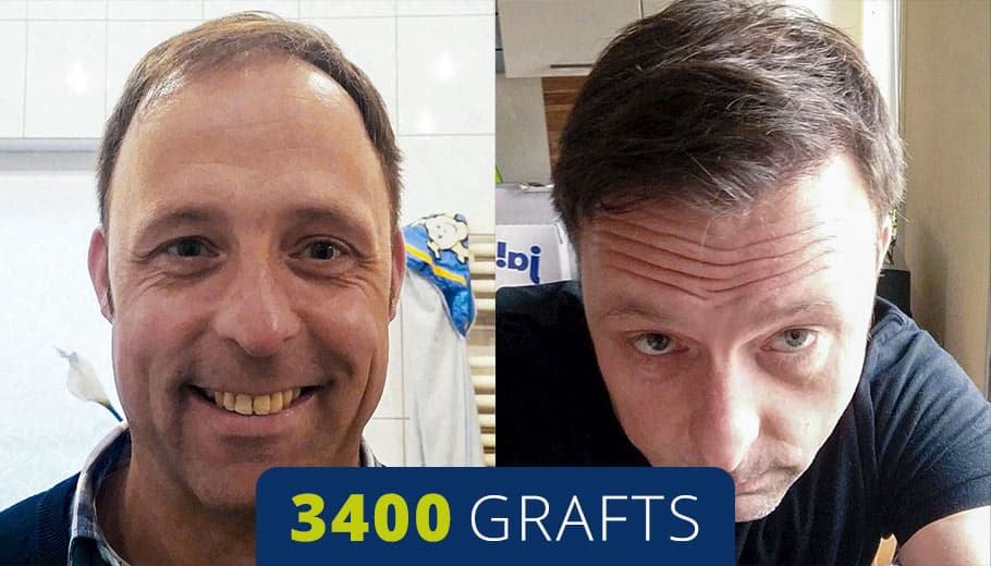 Before and after example