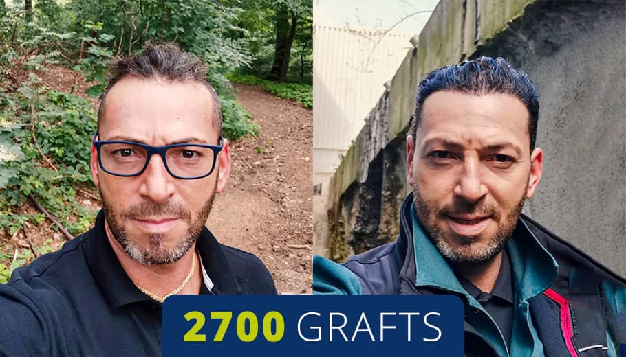 Before and after example