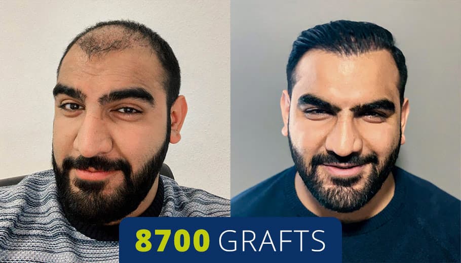 Before and after example