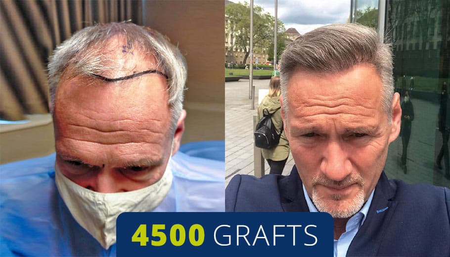 Before and after example