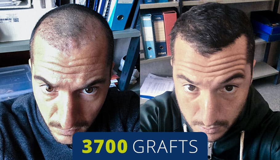 Before and after example