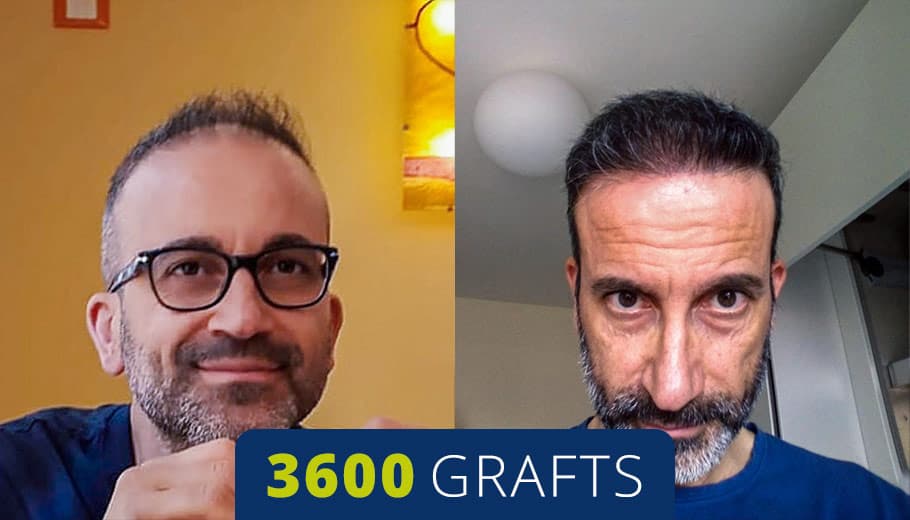 Before and after example