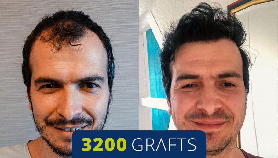 Before and after example