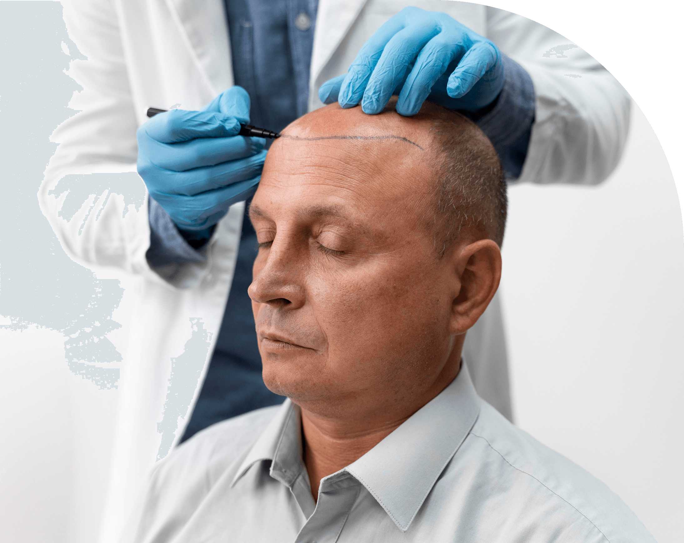 Doctor drawing on patient head